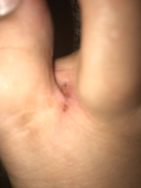 What waddles did to me
