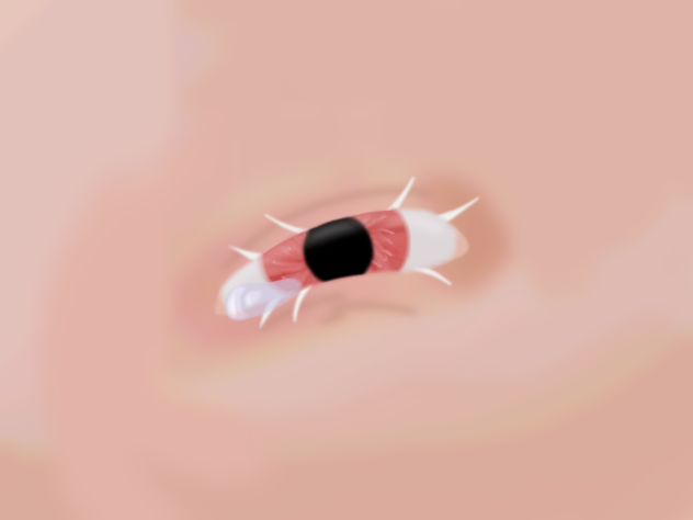 Crying eye