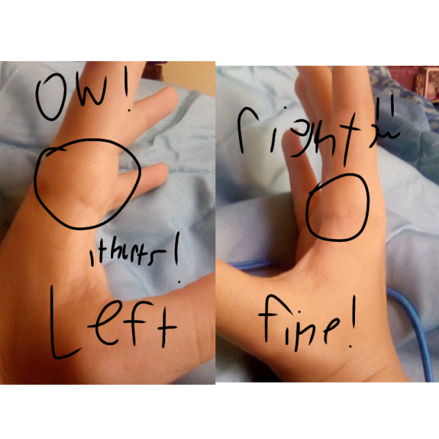 it hurts so much!!!!!!!