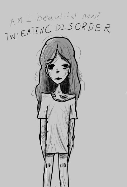 TW EATING DISORDER