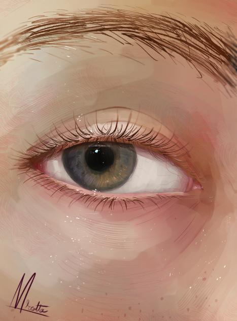 Eye