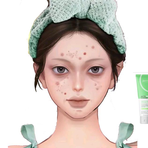 acne girl make up make over!