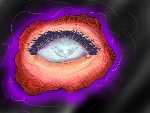 Rose eye