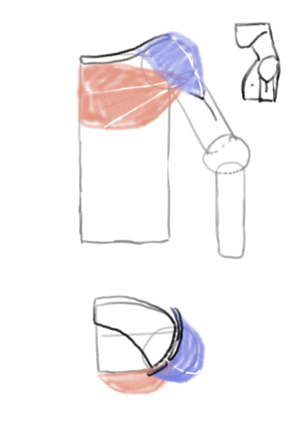 kind draw study 11.19