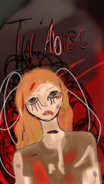 Abuse