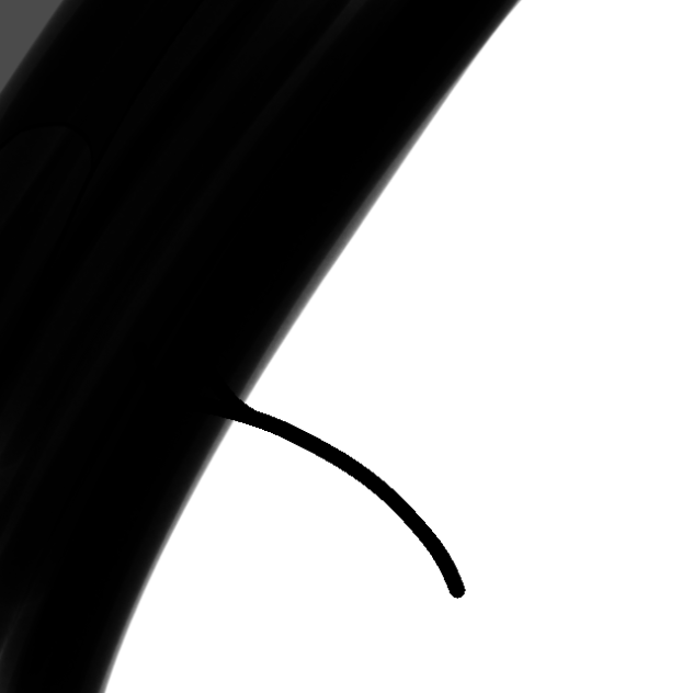 Death In Person