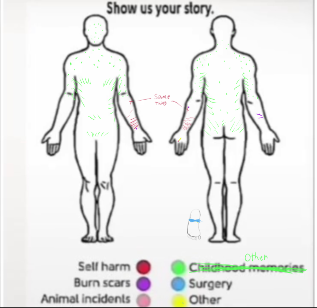 My story