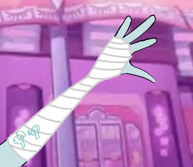 Glace Broke Her Left Arm