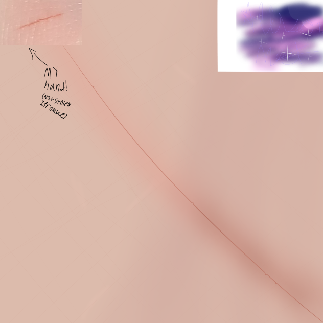 I drew a real cut I just gave myself-