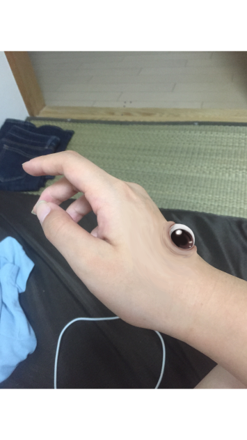 寄生されました