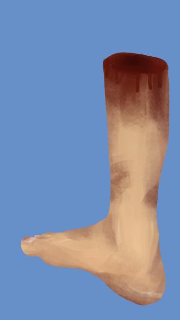 CAN I LICK UR SEVERED LEG (dirty ver)