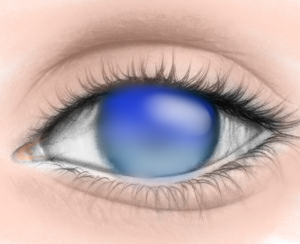 Eye