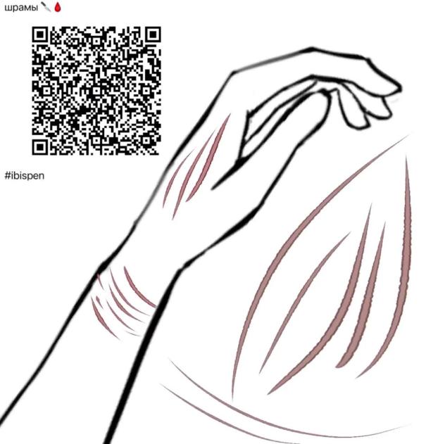 Scratch