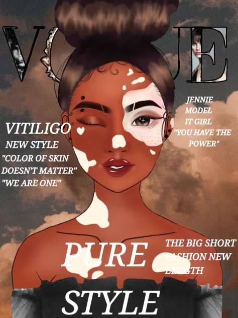 JENNIE OC VITILIGO