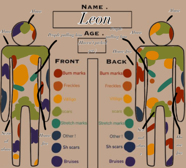 Leon’s scar thing-