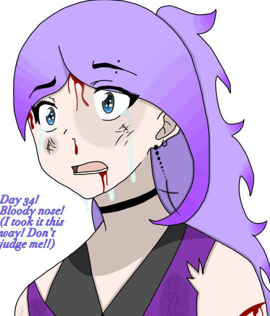 Day 34! Bloody nose!