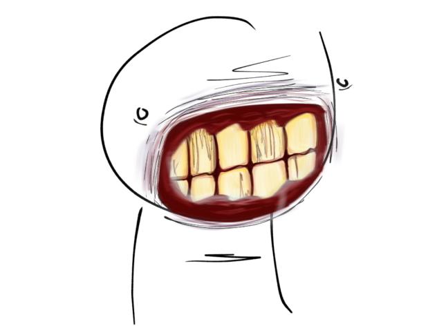Yellow teeth