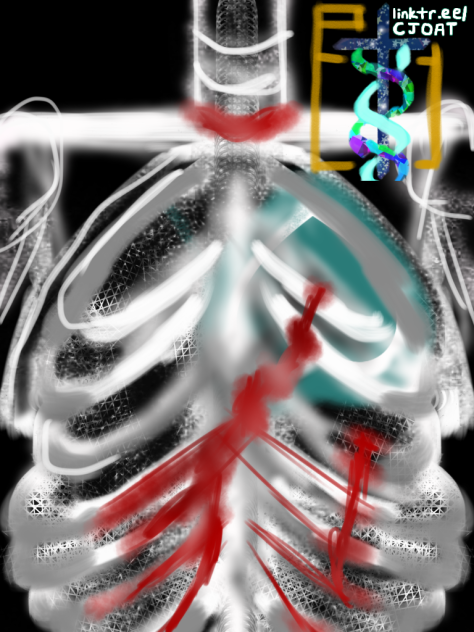 Wounded Ribcage