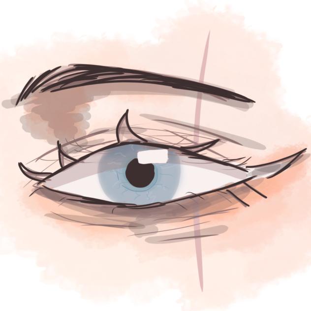 Eye
