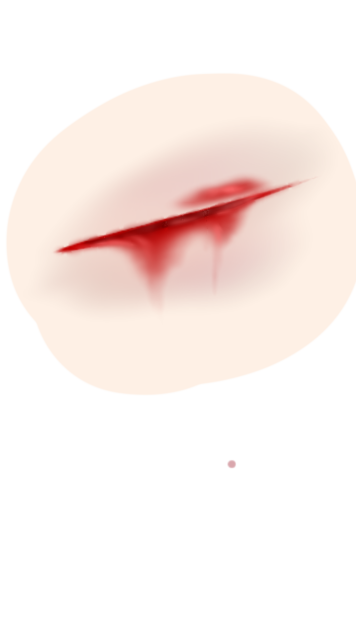 切り傷