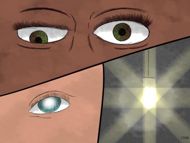 July 9 (lazy eye-astigmatism-cataracts)