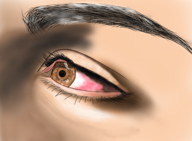 my eye