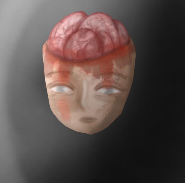 Error