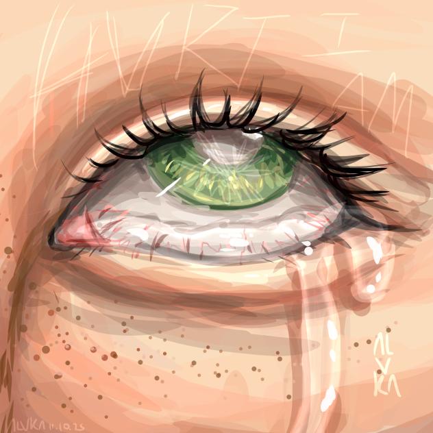 Hurt