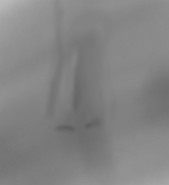 鼻