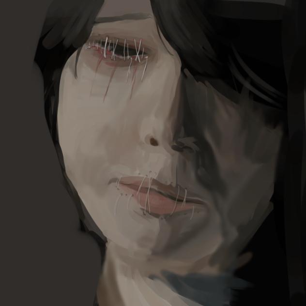 狭心症