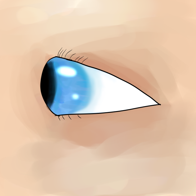 Eye1