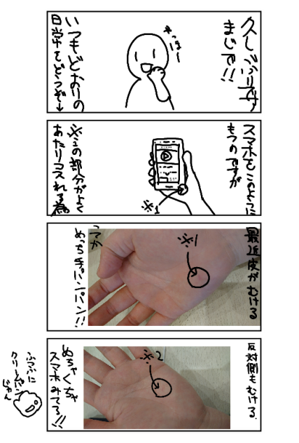 ての皮がむける