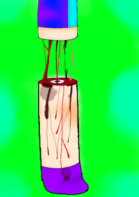 Leg