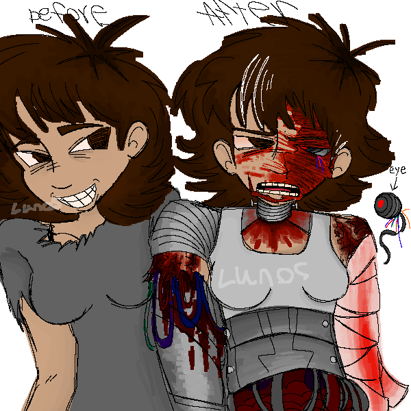 Ihnmnims oc before n after