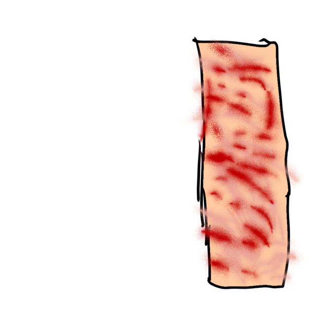 My arms rn