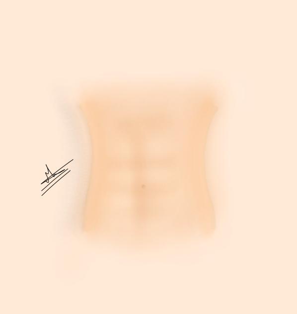 abbs tutorial🤓