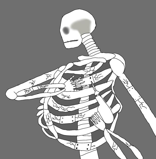 Broken Mr. Skeleton