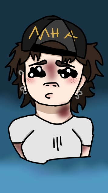 😭allergic reaction😭