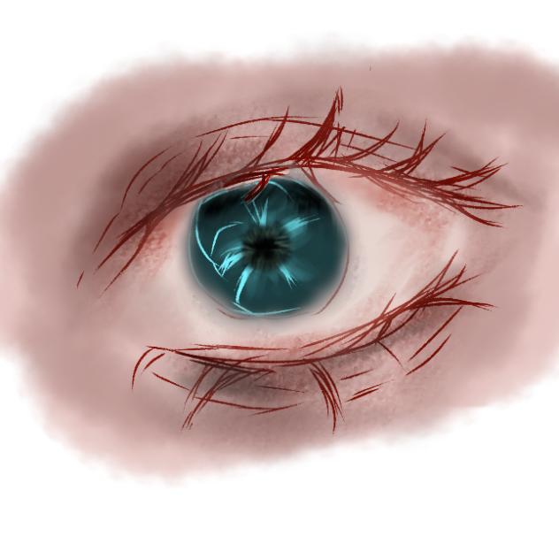 bloodshot
