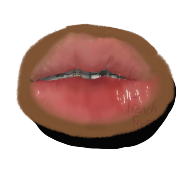 pretty thing braces and lip gloss combo