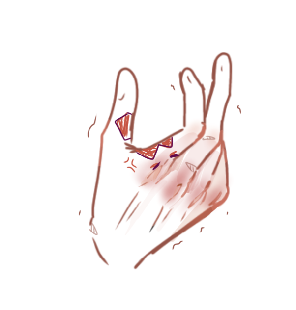 Skill issue hand (mine)