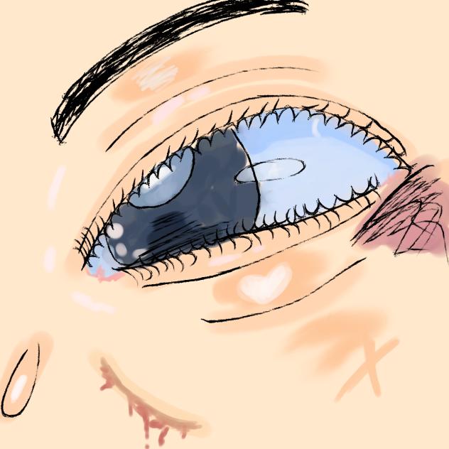EYE