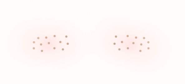 Freckles for anime