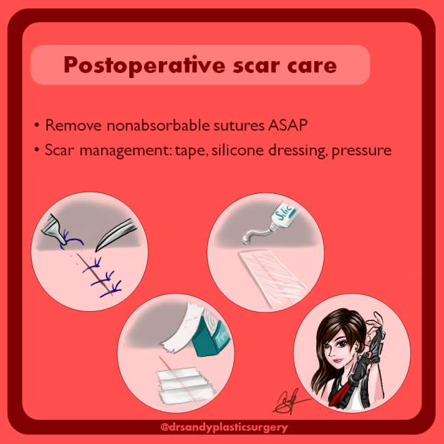 scar factors modifiable 4