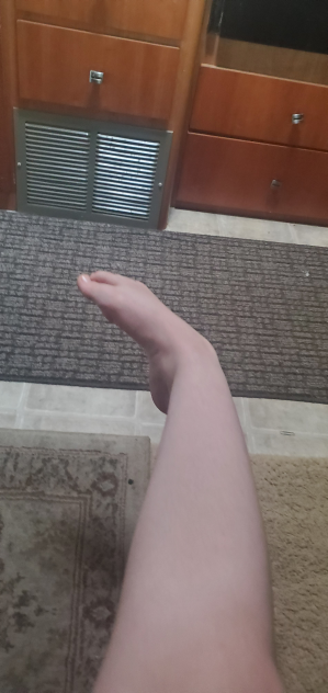 MAH ANKLE- 2