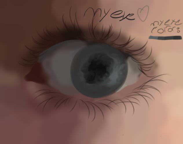 My eye