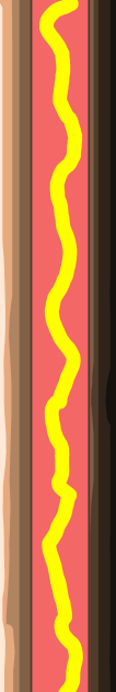 hot dog remake