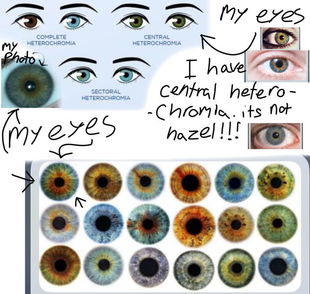 Central heterochromia eyes