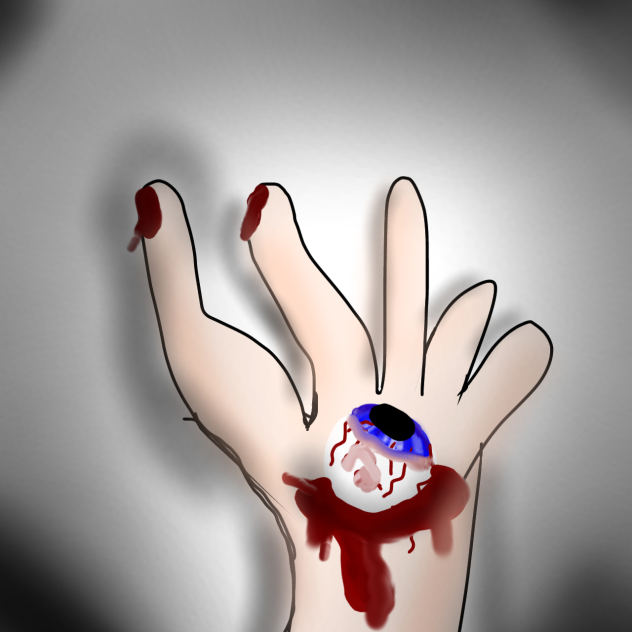 You Die