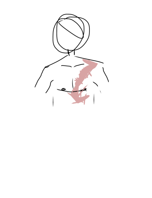 Ace- dis is his scar-